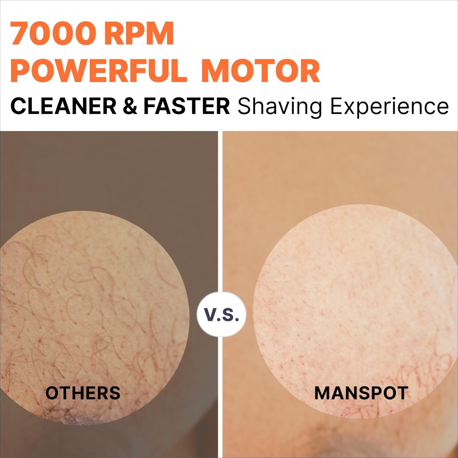 MANSPOT Manscape Groin & Body Hair Trimmer for Men, Electric Ball Trimmer Pubic Trimmer Shaver, Black MANSPOT Manscape Groin & Body Hair Trimmer for Men, Electric Ball Trimmer Pubic Trimmer Shaver, Black - Image 4