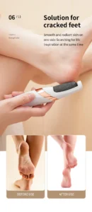 HOMFISH Electric Foot Grinder, Automatic Foot Callus Rubbing Pedicure, Dead Skin Callus Remover, Foot Beauty Machine