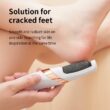 HOMFISH Electric Foot Grinder, Automatic Foot Callus Rubbing Pedicure, Dead Skin Callus Remover, Foot Beauty Machine
