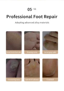HOMFISH Electric Foot Grinder, Automatic Foot Callus Rubbing Pedicure, Dead Skin Callus Remover, Foot Beauty Machine