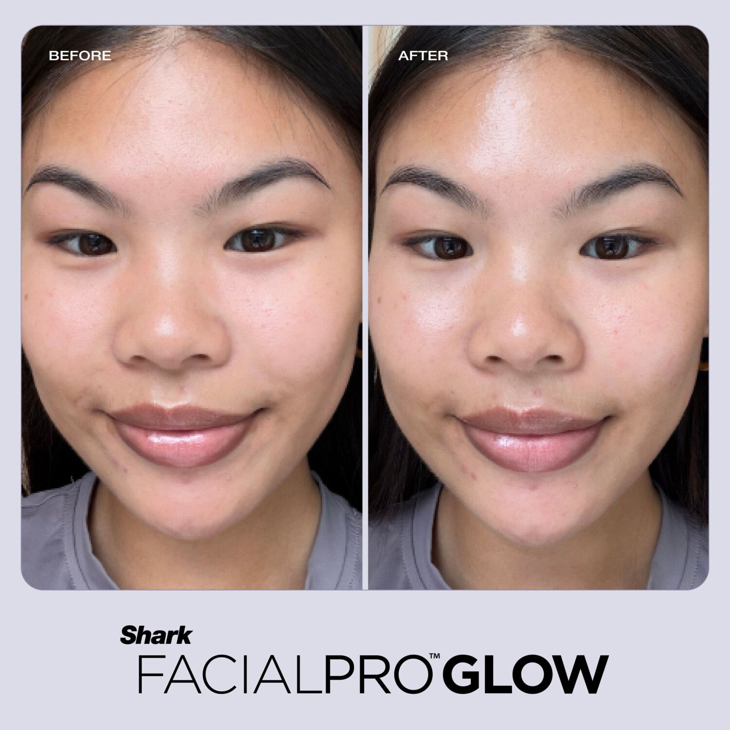 Shark FacialPro Glow At Home Hydro-Powered System - Blue Shark FacialPro Glow At Home Hydro-Powered System - Blue