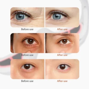 Eye Massager Glasses for Eye Fatigue Relief and Under Eye Relaxation Massage