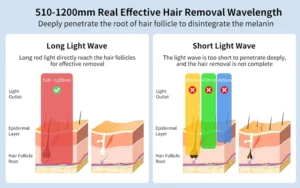 MLAY T18 IPL Hair Removal Device with Ice Cooling – Permanent Laser Hair Removal for Women & Men, Unlimited Flashes, Painless Home Use Epilator